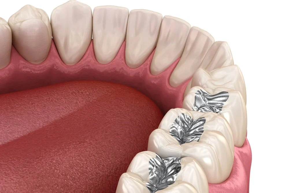 mercury fillings diagram showing health concerns linked to